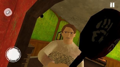 \